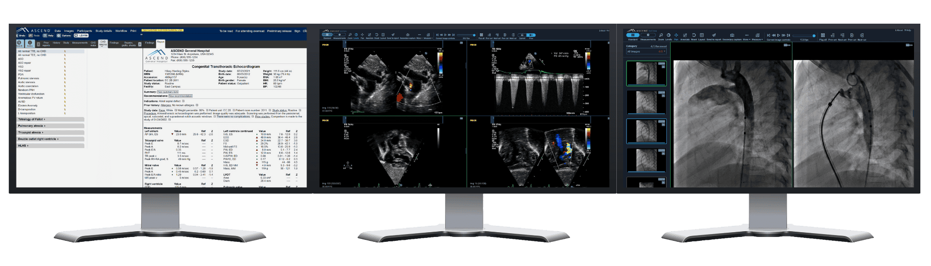 Monitors showing health results